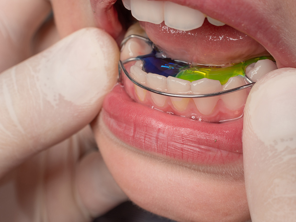 Dentofacial Orthopaedics