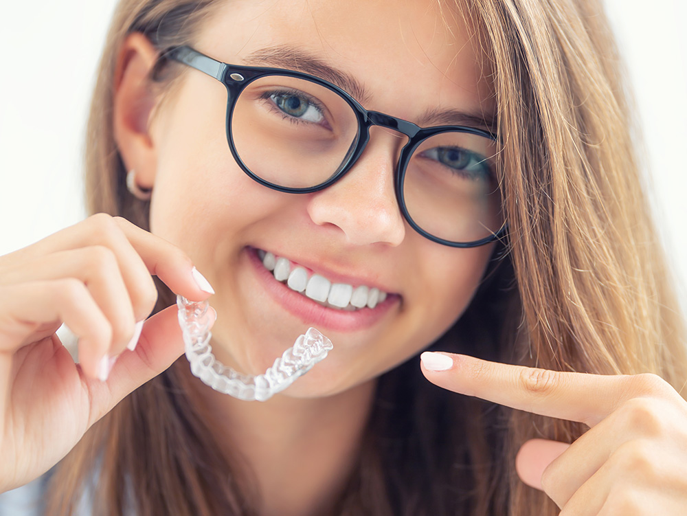 Invisalign® Aligners